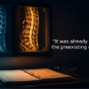 Radiology lightbox showing two spinal MRI films side by side, one lit cool blue and one warm amber, above an open case binder